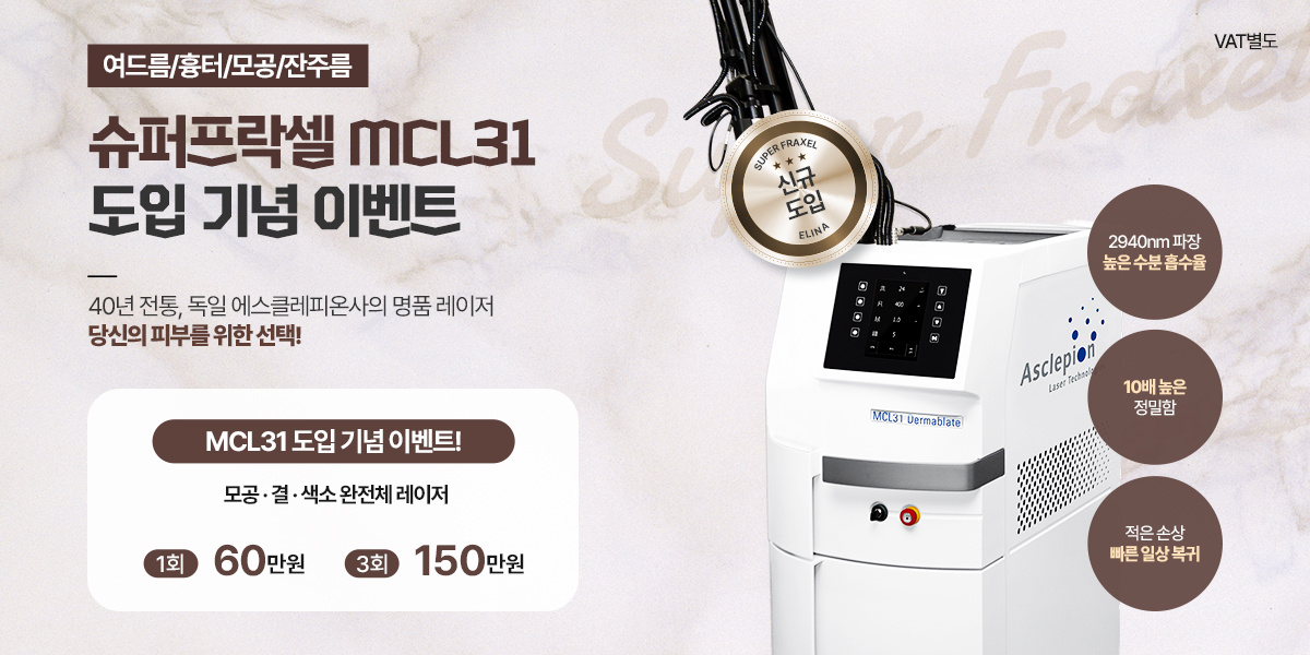 MCL31 도입 이벤트